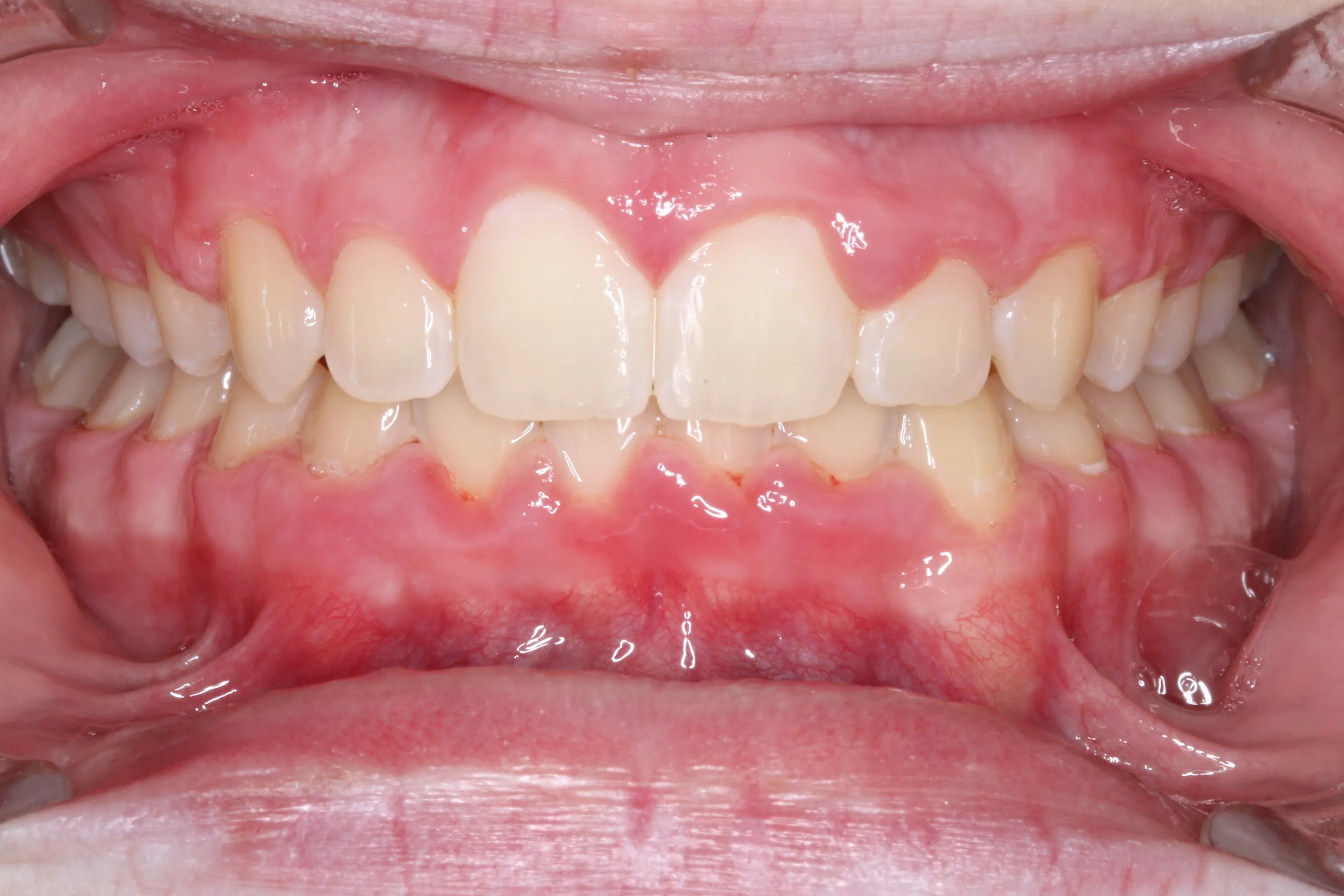 smile-gallery gallery